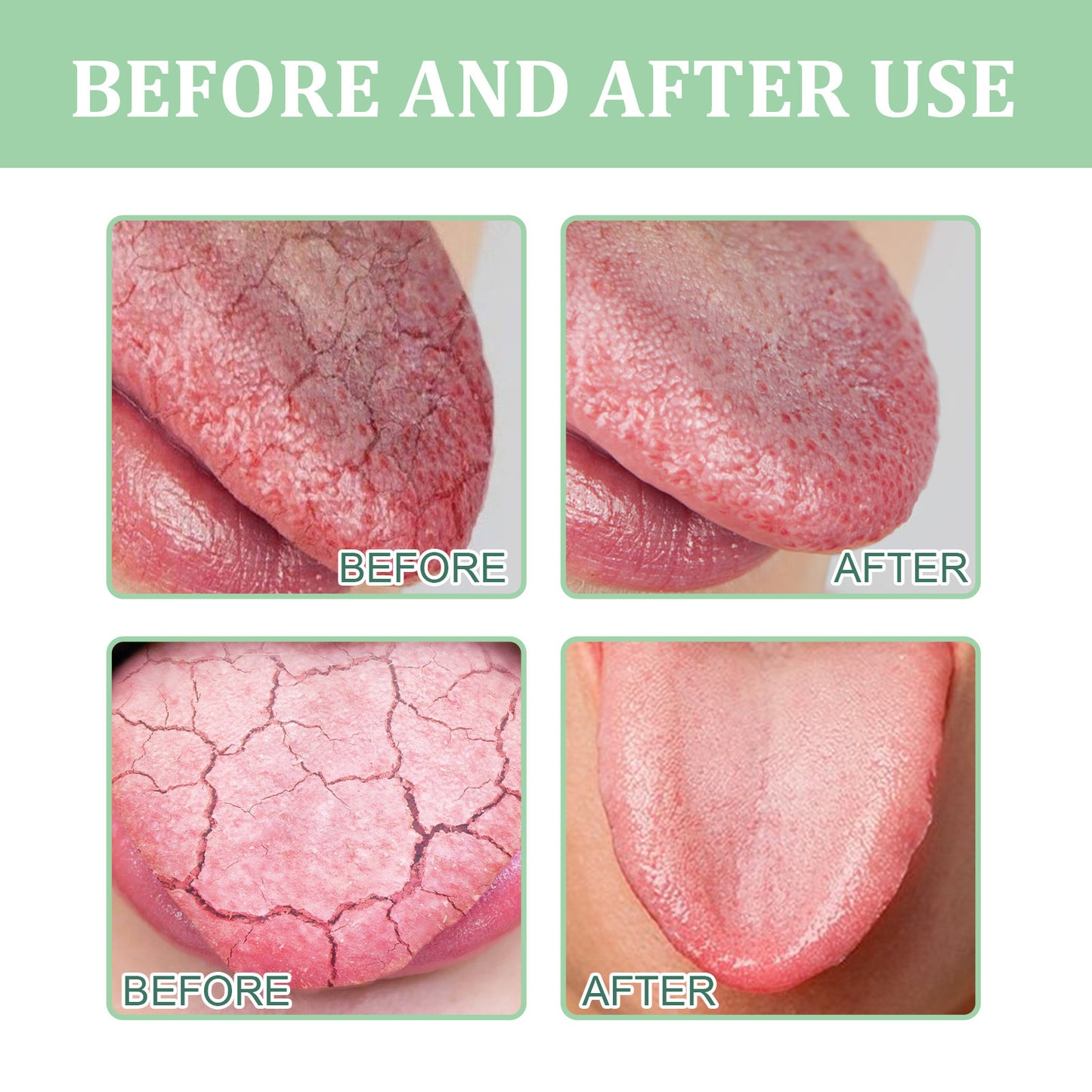 Odor Removing Oral Cracked Tongue Relief Spray