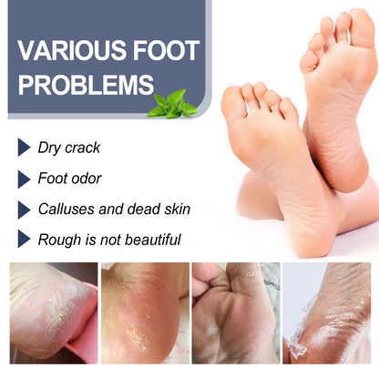 Foot Chapped Replenishment Care Spray