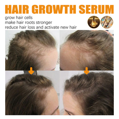 EELHOE Biotin Hair Dense Hair Spray Repair Hair Nourishing Hair Care Hair Fixing Strong And Tough Anti-hair Loss Root Spray